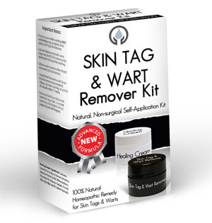 Are Creams For Skin Tag Removal Safe?