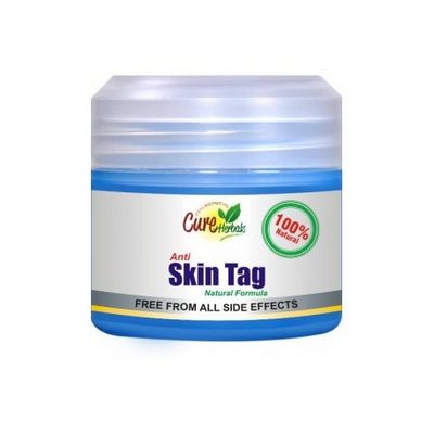 Are Creams For Skin Tag Removal Safe?