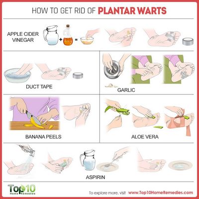 Effective Natural Remedies For Plantar Wart