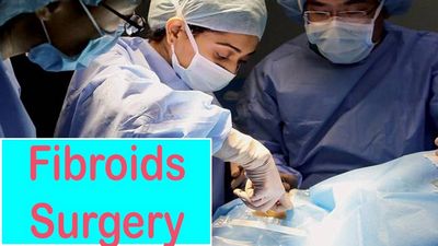 Fibroids Surgery - How to Remove Fibroids From the Body