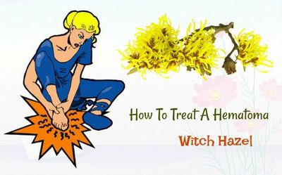 How to Treat Hematema Naturally