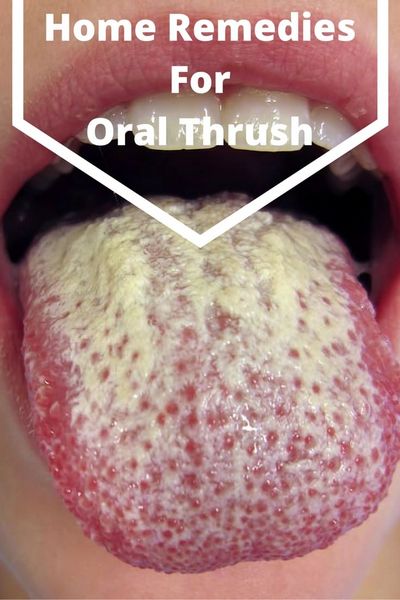 Mupirocin, Oral Thrush and Antifungal Drugs