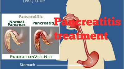 Pancreatitis Treatment - An Overview