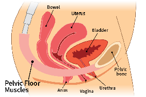 Pelvic Floor Dysfunction - What is Pelvic Torsion?