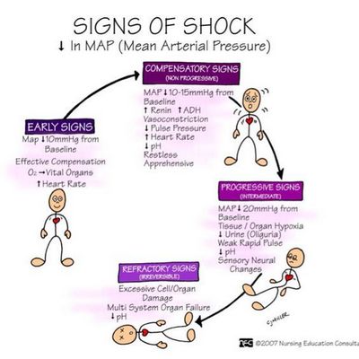 Symptoms of Septic Shock