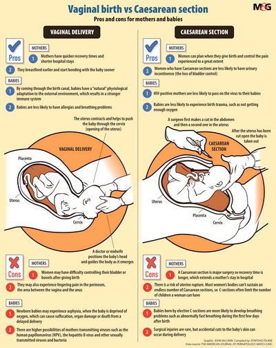 The Benefits and Disadvantages of a C Section