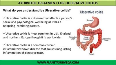 Ulcer-Colitis Treatment