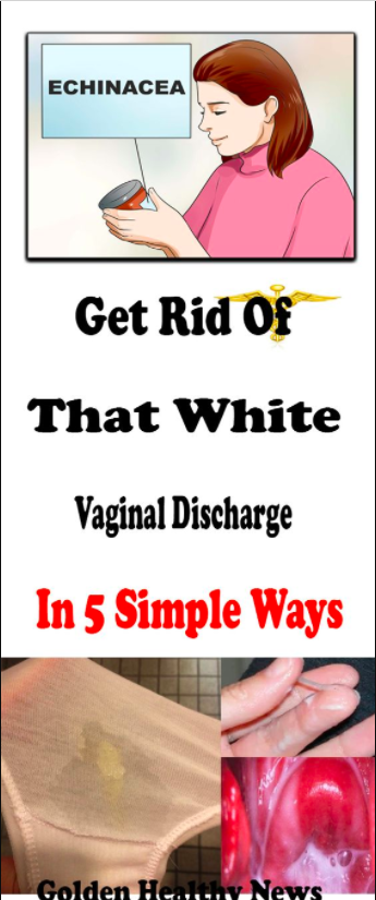 White Discharge - Get Rid of the Discomfort
